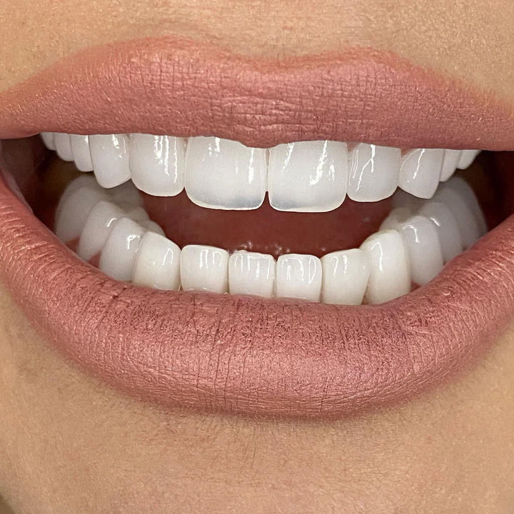 Caz Before & After realizat de Dr. Yazan Aq.