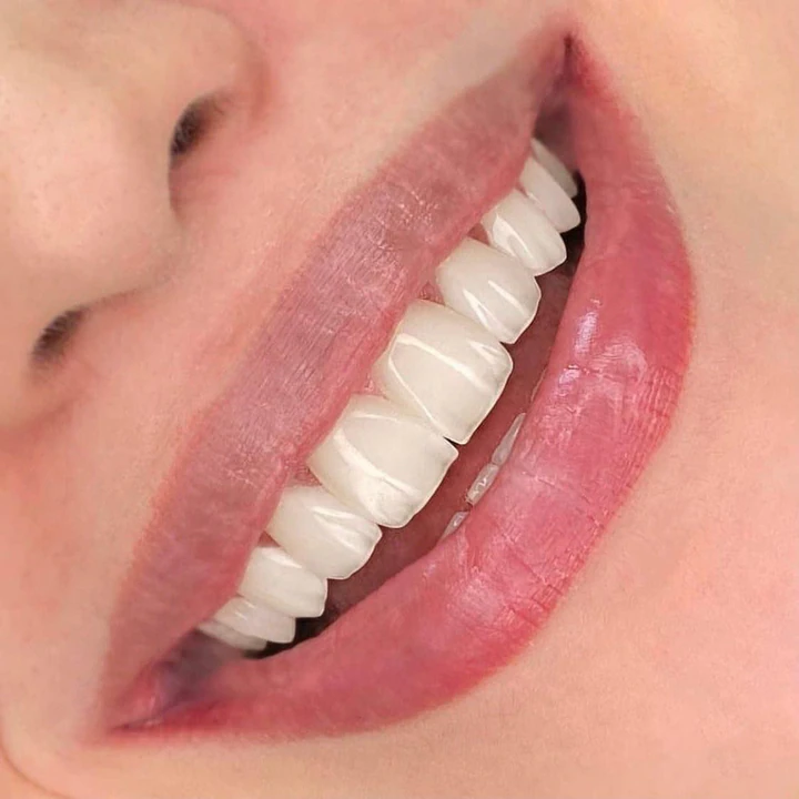 Caz Before & After realizat de Dr. Yazan Aq.