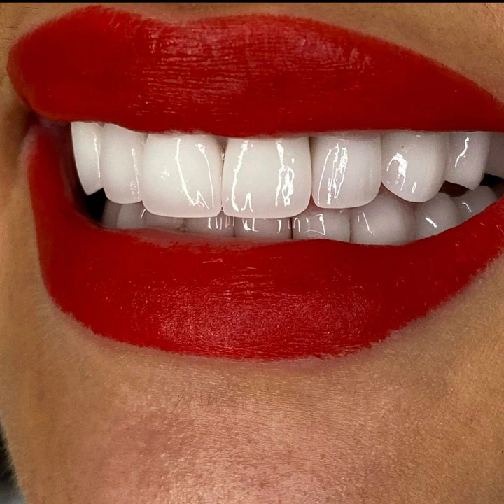 Caz Before & After realizat de Dr. Yazan Aq.