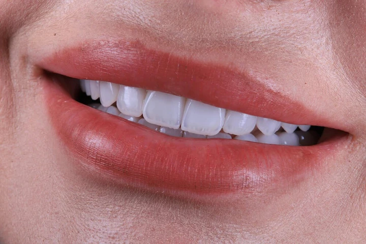 Caz Before & After realizat de Dr. Yazan Aq.