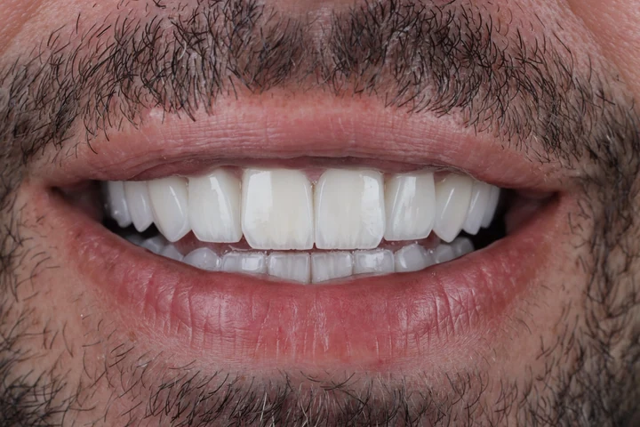 Zâmbet realizat de Dr. Yazan Aq.